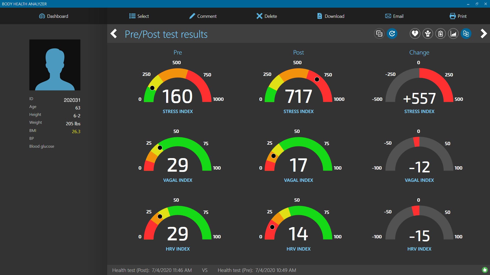 Body Health Analyzer Pre-Post Hill Climb Bike Report